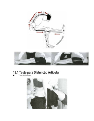 12.1 Teste para Disfunção Articular
    Teste de Schober.
 