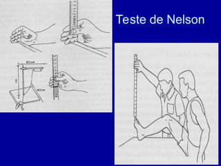 Teste de Nelson
 