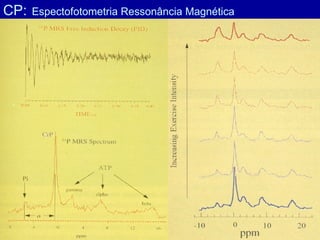 CP: Espectofotometria Ressonância Magnética
 