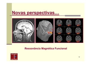 Novas perspectivas…

Ressonância Magnética Funcional

19

 