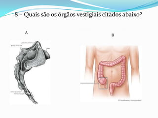 8 – Quais são os órgãos vestigiais citados abaixo?

    A
                                     B
 