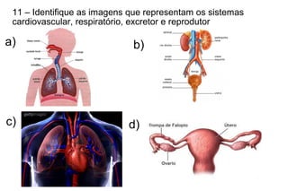 a) b)
c)
11 – Identifique as imagens que representam os sistemas
cardiovascular, respiratório, excretor e reprodutor
d)
 