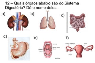 12 – Quais órgãos abaixo são do Sistema
Digestório? Dê o nome deles.
a) b) c)
d) e) f)
 