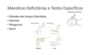 Manobras Deficitárias e Testes Específicos
• Manobra dos braços Estendidos
• Raimiste
• Mingazzine
• Barré
 
