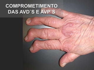 COMPROMETIMENTO
 DAS AVD`S E AVP`S
 