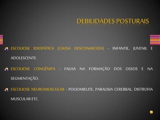 DEBILIDADES POSTURAIS
ESCOLIOSE IDIOPÁTICA (CAUSA DESCONHECIDA) - INFANTIL, JUVENIL E
ADOLESCENTE.
ESCOLIOSE CONGÊNITA - FALHA NA FORMAÇÃO DOS OSSOS E NA
SEGMENTAÇÃO.
ESCOLIOSE NEUROMUSCULAR - POLIOMIELITE, PARALISIA CEREBRAL, DISTROFIA
MUSCULAR ETC.
 