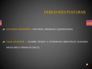 DEBILIDADES POSTURAIS
ESCOLIOSE TRAUMÁTICA - FRATURAS, CIRURGIAS E QUEIMADURAS.
FALSA ESCOLIOSE – OCORRE DEVIDO A FENÔMENOS IRRITATIVOS (TUMORES
MEDULARES E HÉRNIA DE DISCO).
 