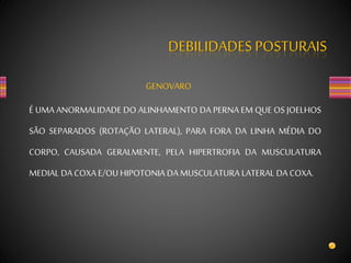 DEBILIDADES POSTURAIS
GENOVARO
É UMA ANORMALIDADE DO ALINHAMENTO DA PERNA EM QUE OS JOELHOS
SÃO SEPARADOS (ROTAÇÃO LATERAL), PARA FORA DA LINHA MÉDIA DO
CORPO, CAUSADA GERALMENTE, PELA HIPERTROFIA DA MUSCULATURA
MEDIAL DA COXAE/OUHIPOTONIA DA MUSCULATURA LATERAL DA COXA.
 