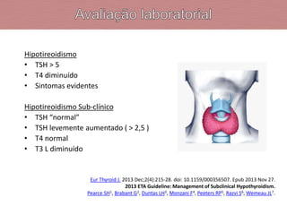 Hipotireoidismo
• TSH > 5
• T4 diminuído
• Sintomas evidentes
Hipotireoidismo Sub-clínico
• TSH “normal”
• TSH levemente aumentado ( > 2,5 )
• T4 normal
• T3 L diminuído
Eur Thyroid J. 2013 Dec;2(4):215-28. doi: 10.1159/000356507. Epub 2013 Nov 27.
2013 ETA Guideline: Management of Subclinical Hypothyroidism.
Pearce SH1, Brabant G2, Duntas LH3, Monzani F4, Peeters RP5, Razvi S6, Wemeau JL7.
 