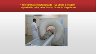 ▪ Tomografia computadorizada (TC): utiliza a imagem
reproduzida pelos raios X como forma de diagnóstico.
 