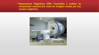 ▪ Ressonância Magnética (RM): Possibilita a análise da
composição corporal por meio da imagem criada por seu
campo magnético.
 