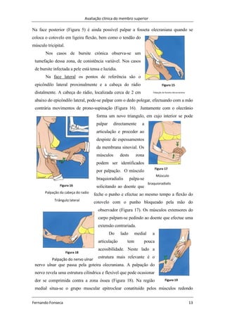 Avaliação clínica do membro superior
Fernando Fonseca 13
Figura 15
Palpação da fosseta olecocraniana
Figura 18
Palpação do nervo ulnar
Figura 17
Músculo
braquioradialis
Na face posterior (Figura 5) é ainda possível palpar a fosseta olecraniana quando se
coloca o cotovelo em ligeira flexão, bem como o tendão do
músculo tricipital.
Nos casos de bursite crónica observa-se um
tumefação dessa zona, de conistência variável. Nos casos
de bursite infectada a pele está tensa e luzidia.
Na face lateral os pontos de referência são o
epicôndilo lateral proximalmente e a cabeça do rádio
distalmente. A cabeça do rádio, localizada cerca de 2 cm
abaixo do epicôndilo lateral, pode-se palpar com o dedo polegar, efectuando com a mão
contrária movimentos de prono-supinação (Figura 16). Juntamente com o olecrânio
forma um novo triangulo, em cujo interior se pode
palpar directamente a
articulação e proceder ao
despiste de espessamentos
da membrana sinovial. Os
músculos dests zona
podem ser identificados
por palpação. O músculo
braquioradialis palpa-se
solicitando ao doente que
feche o punho e efectue ao mesmo tempo a flexão do
cotovelo com o punho bloqueado pela mão do
observador (Figura 17). Os músculos extensores do
carpo palpam-se pedindo ao doente que efectue uma
extensão contrariada.
Do lado medial a
articulação tem pouca
acessibilidade. Neste lado a
estrutura mais relevante é o
nervo ulnar que passa pela goteira olecraniana. A palpação do
nervo revela uma estrutura cilíndrica e flexível que pode ocasionar
dor se comprimida contra a zona óssea (Figura 18). Na região
medial situa-se o grupo muscular epitroclear conatituído pelos músculos redondo
Figura 16
Palpação da cabeça do radio
Triângulo lateral
Figura 19
 