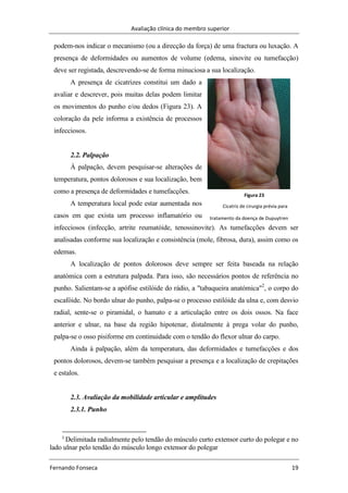 Avaliação clínica do membro superior
Fernando Fonseca 19
Figura 23
Cicatriz de cirurgia prévia para
tratamento da doença de Dupuytren
podem-nos indicar o mecanismo (ou a direcção da força) de uma fractura ou luxação. A
presença de deformidades ou aumentos de volume (edema, sinovite ou tumefacção)
deve ser registada, descrevendo-se de forma minuciosa a sua localização.
A presença de cicatrizes constitui um dado a
avaliar e descrever, pois muitas delas podem limitar
os movimentos do punho e/ou dedos (Figura 23). A
coloração da pele informa a existência de processos
infecciosos.
2.2. Palpação
À palpação, devem pesquisar-se alterações de
temperatura, pontos dolorosos e sua localização, bem
como a presença de deformidades e tumefacções.
A temperatura local pode estar aumentada nos
casos em que exista um processo inflamatório ou
infecciosos (infecção, artrite reumatóide, tenossinovite). As tumefacções devem ser
analisadas conforme sua localização e consistência (mole, fibrosa, dura), assim como os
edemas.
A localização de pontos dolorosos deve sempre ser feita baseada na relação
anatómica com a estrutura palpada. Para isso, são necessários pontos de referência no
punho. Salientam-se a apófise estilóide do rádio, a "tabaqueira anatómica"2
, o corpo do
escafóide. No bordo ulnar do punho, palpa-se o processo estilóide da ulna e, com desvio
radial, sente-se o piramidal, o hamato e a articulação entre os dois ossos. Na face
anterior e ulnar, na base da região hipotenar, distalmente à prega volar do punho,
palpa-se o osso pisiforme em continuidade com o tendão do flexor ulnar do carpo.
Ainda à palpação, além da temperatura, das deformidades e tumefacções e dos
pontos dolorosos, devem-se também pesquisar a presença e a localização de crepitações
e estalos.
2.3. Avaliação da mobilidade articular e amplitudes
2.3.1. Punho
2
Delimitada radialmente pelo tendão do músculo curto extensor curto do polegar e no
lado ulnar pelo tendão do músculo longo extensor do polegar
 