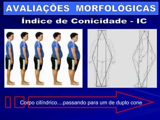 AVALIAÇÕES  MORFOLÓGICAS Índice de Conicidade - IC Corpo cilíndrico....passando para um de duplo cone   