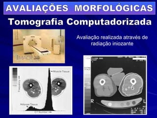 AVALIAÇÕES  MORFOLÓGICAS Tomografia Computadorizada Avaliação realizada através de radiação iniozante 