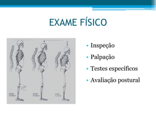 EXAME FÍSICO
• Inspeção
• Palpação
• Testes específicos
• Avaliação postural
 