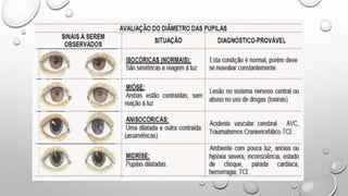 AVALIA O NEUROLOGICA DAS PUPILAS pptx
