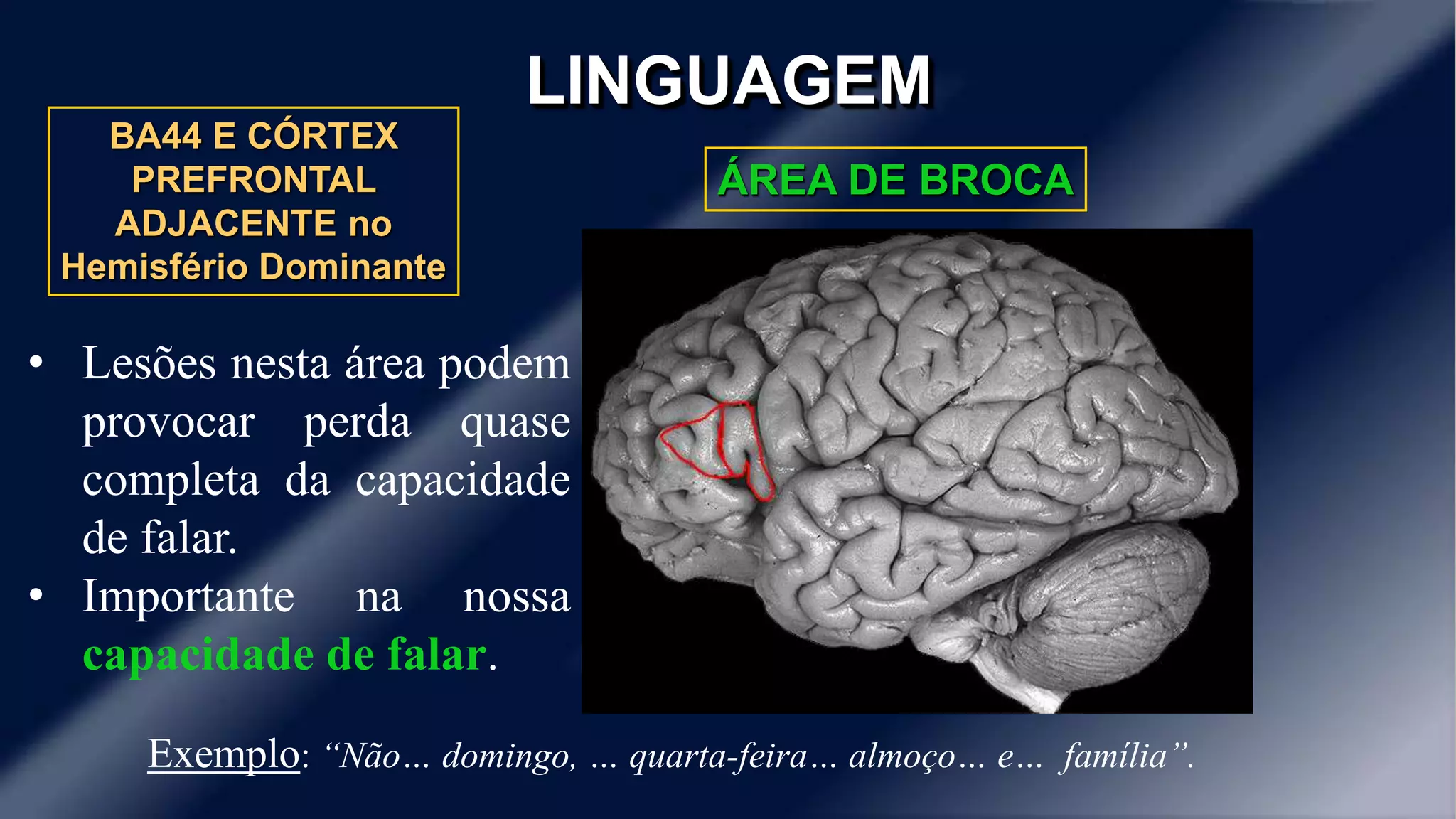 LINGUAGEM 
ÁREA DE BROCA 
BA44 E CÓRTEX 
PREFRONTAL 
ADJACENTE no 
Hemisfério Dominante 
• Lesões nesta área podem 
provocar perda quase 
completa da capacidade 
de falar. 
• Importante na nossa 
capacidade de falar. 
Exemplo: “Não… domingo, … quarta-feira… almoço… e… família”. 
 