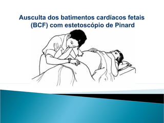 Ausculta dos batimentos cardíacos fetais
(BCF) com estetoscópio de Pinard
 