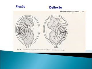 Flexão Deflexão
 
