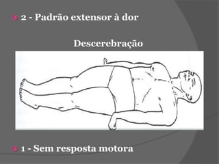  2 - Padrão extensor à dor 
Descerebração 
 1 - Sem resposta motora 
 