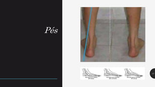Pés
13
 