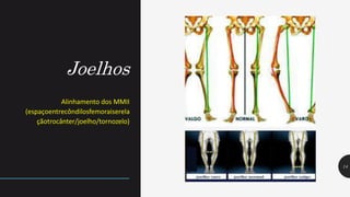 Joelhos
14
Alinhamento dos MMII
(espaçoentrecôndilosfemoraiserela
çãotrocânter/joelho/tornozelo)
 