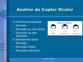 Leonardo Delgado
Analise do Captor Ocular
Analise do Captor Ocular
O alinhamento bipupilar:
- Alinhado;
- Elevação do olho direito
- Elevação do olho
esquerdo
O alinhamento labial:
- Alinhado;
- Elevação direita
- Elevação esquerda
 