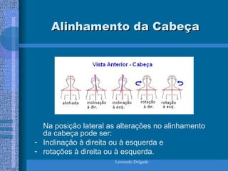 Leonardo Delgado
Alinhamento da Cabeça
Alinhamento da Cabeça
Na posição lateral as alterações no alinhamento
da cabeça pode ser:
- Inclinação à direita ou à esquerda e
- rotações à direita ou à esquerda.
 
