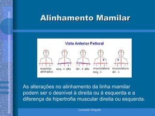 Leonardo Delgado
Alinhamento Mamilar
Alinhamento Mamilar
As alterações no alinhamento da linha mamilar
podem ser o desnível à direita ou à esquerda e a
diferença de hipertrofia muscular direita ou esquerda.
 
