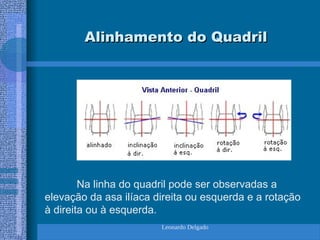 Leonardo Delgado
Alinhamento do Quadril
Alinhamento do Quadril
Na linha do quadril pode ser observadas a
elevação da asa ilíaca direita ou esquerda e a rotação
à direita ou à esquerda.
 