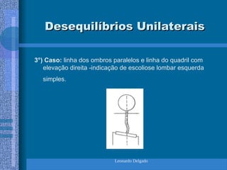 Leonardo Delgado
Desequilíbrios Unilaterais
Desequilíbrios Unilaterais
3°) Caso: linha dos ombros paralelos e linha do quadril com
elevação direita -indicação de escoliose lombar esquerda
simples.
 