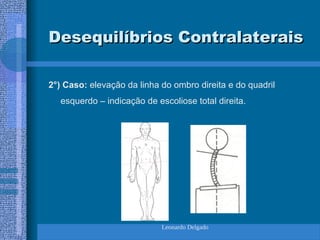 Leonardo Delgado
Desequilíbrios Contralaterais
Desequilíbrios Contralaterais
2°) Caso: elevação da linha do ombro direita e do quadril
esquerdo – indicação de escoliose total direita.
 