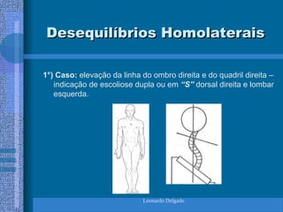 Leonardo Delgado
Desequilíbrios Homolaterais
Desequilíbrios Homolaterais
1°) Caso: elevação da linha do ombro direita e do quadril direita –
indicação de escoliose dupla ou em “S” dorsal direita e lombar
esquerda.
 