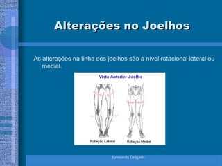 Leonardo Delgado
Alterações no Joelhos
Alterações no Joelhos
As alterações na linha dos joelhos são a nível rotacional lateral ou
medial.
 