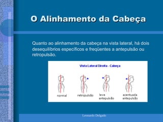 Leonardo Delgado
O Alinhamento da Cabeça
O Alinhamento da Cabeça
Quanto ao alinhamento da cabeça na vista lateral, há dois
desequilíbrios específicos e freqüentes a antepulsão ou
retropulsão.
 