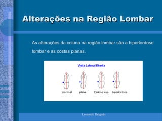 Leonardo Delgado
Alterações na Região Lombar
Alterações na Região Lombar
As alterações da coluna na região lombar são a hiperlordose
lombar e as costas planas.
 