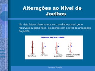 Leonardo Delgado
Alterações ao Nível de
Alterações ao Nível de
Joelhos
Joelhos
Na vista lateral observamos se o avaliado possui genu
recurvato ou geno flexo, de acordo com o nível de arqueação
do joelho.
 