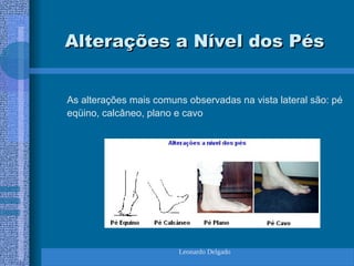 Leonardo Delgado
Alterações a Nível dos Pés
Alterações a Nível dos Pés
As alterações mais comuns observadas na vista lateral são: pé
eqüino, calcâneo, plano e cavo
 
