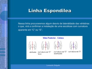 Leonardo Delgado
Linha Espondilea
Linha Espondilea
Nessa linha procuraremos algum desvio de lateralidade das vértebras
o que, virá a confirmar a instalação de uma escoliose com curvatura
aparente em “C” ou “S”;
 