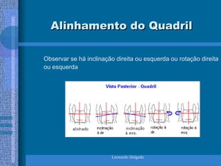 Leonardo Delgado
Alinhamento do Quadril
Alinhamento do Quadril
Observar se há inclinação direita ou esquerda ou rotação direita
ou esquerda
 
