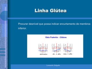 Leonardo Delgado
Linha Glútea
Linha Glútea
Procurar desnível que possa indicar encurtamento de membros
inferior.
 