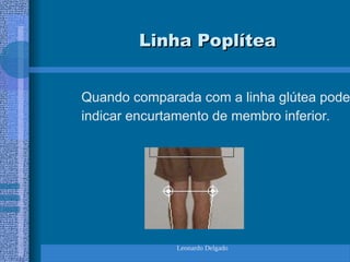 Leonardo Delgado
Linha Poplítea
Linha Poplítea
Quando comparada com a linha glútea pode
indicar encurtamento de membro inferior.
 