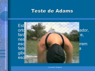 Leonardo Delgado
Teste de Adams
Teste de Adams
Estando o testado em posição
ortostática, de frente para o avaliador,
fará uma antero-flexão de tronco e,
nesta posição, caso possua uma
escoliose e suas vértebras já tiverem
feito uma rotação, aparecerá uma
gibosidade no local da curvatura
escoliótica.
 