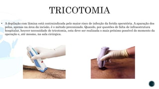 • A depilação com lâmina está contraindicada pelo maior risco de infecção da ferida operatória. A aparação dos
pelos, apenas na área da incisão, é o método preconizado. Quando, por questões de falta de infraestrutura
hospitalar, houver necessidade de tricotomia, esta deve ser realizada o mais próximo possível do momento da
operação e, até mesmo, na sala cirúrgica.
 