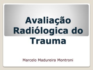 Avaliação
Radiólogica do
Trauma
Marcelo Madureira Montroni
 