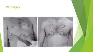 Palpação
 