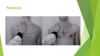 Palpação
 