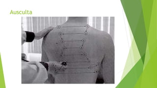 Ausculta
 
