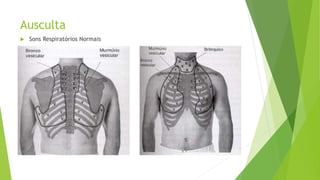 Ausculta
 Sons Respiratórios Normais
 